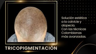 clinicas depilacion laser san pedro sula Micropigmentacion Honduras